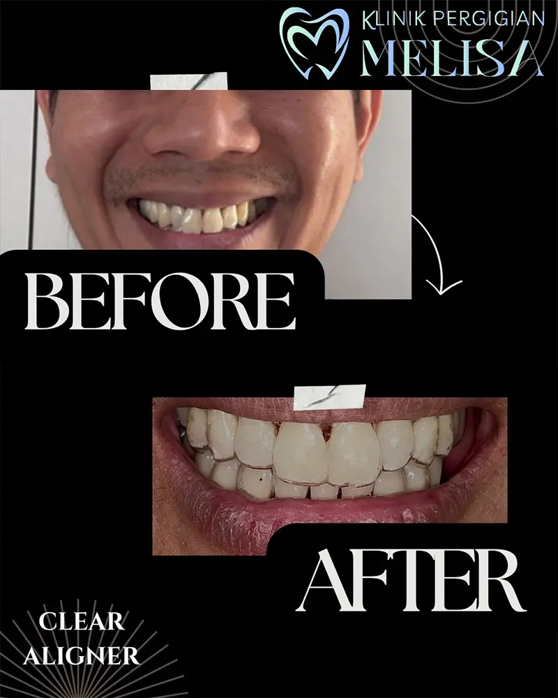 klinik gigi melisa sepang 1