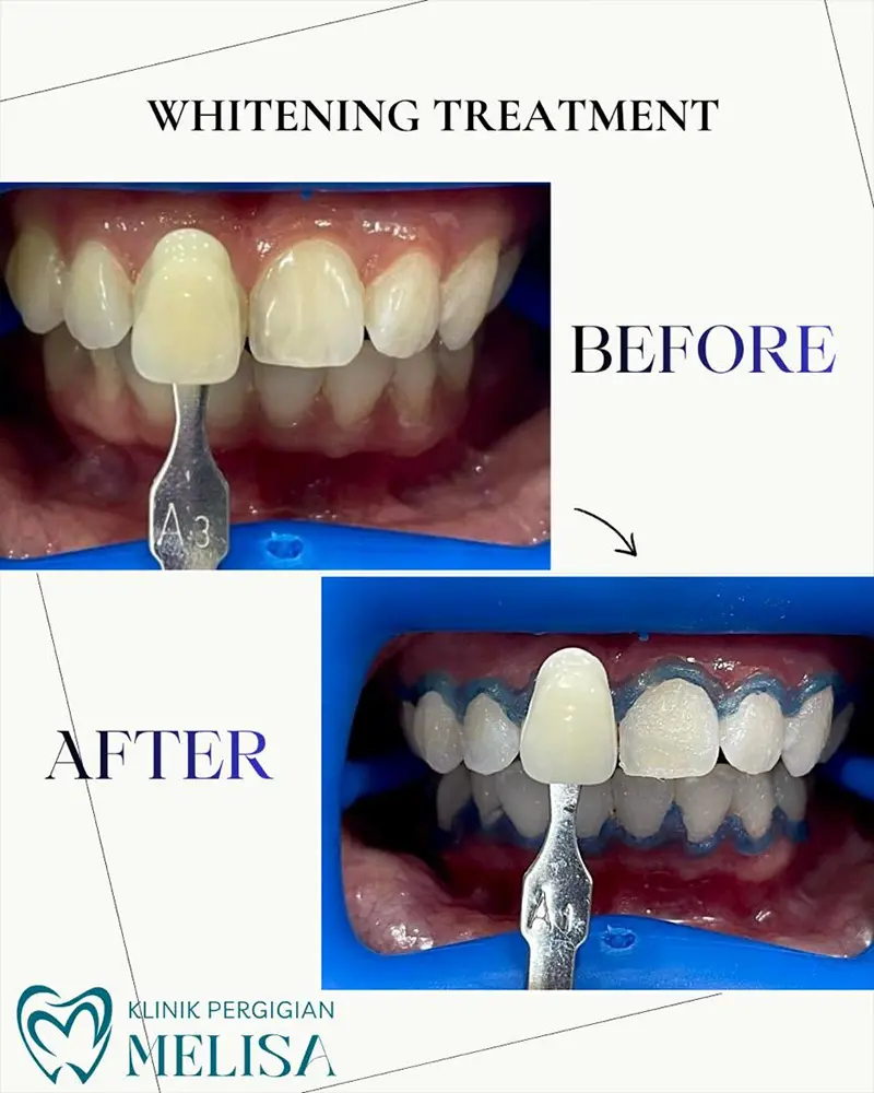 klinik gigi melisa sepang 2