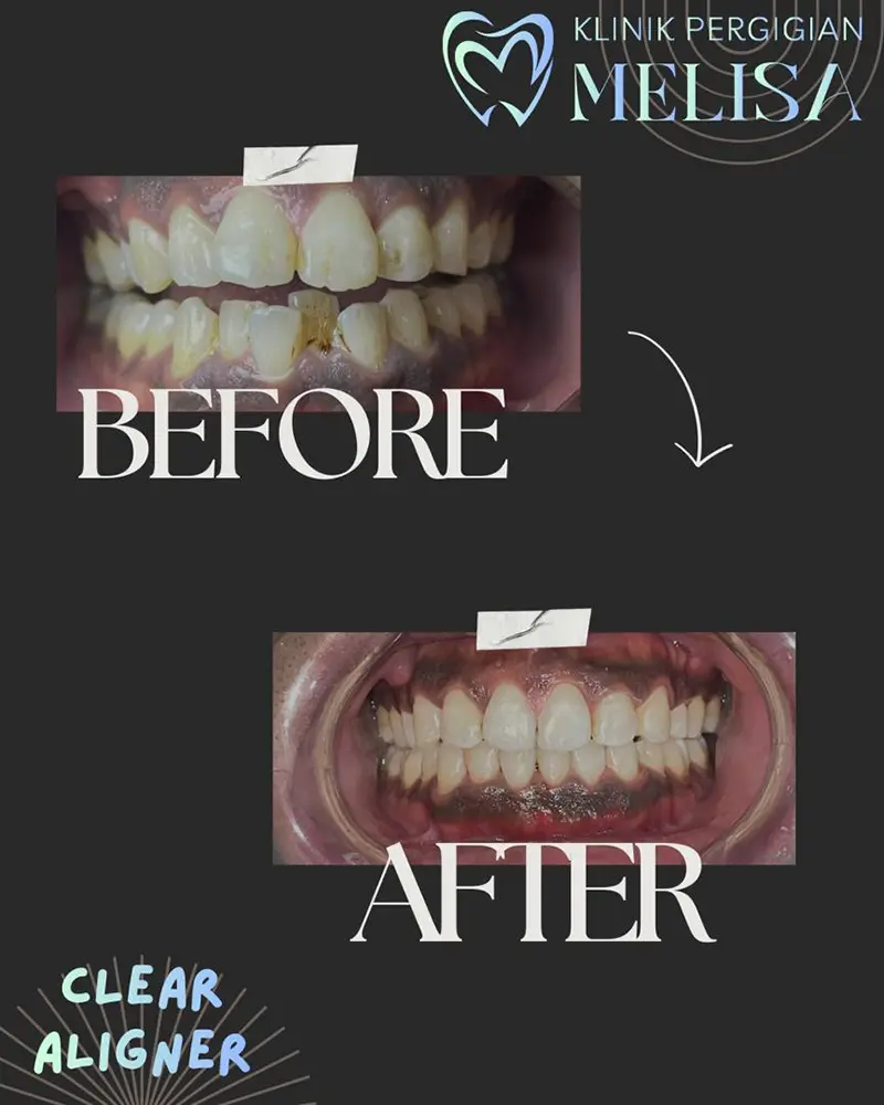klinik gigi melisa sepang 3